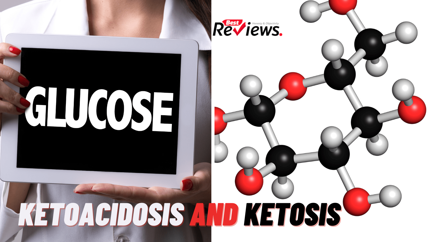 Ketoacidosis and ketosis
